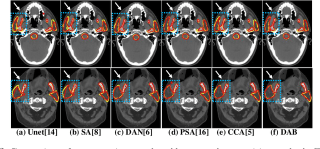 Figure 4 for Local block-wise self attention for normal organ segmentation