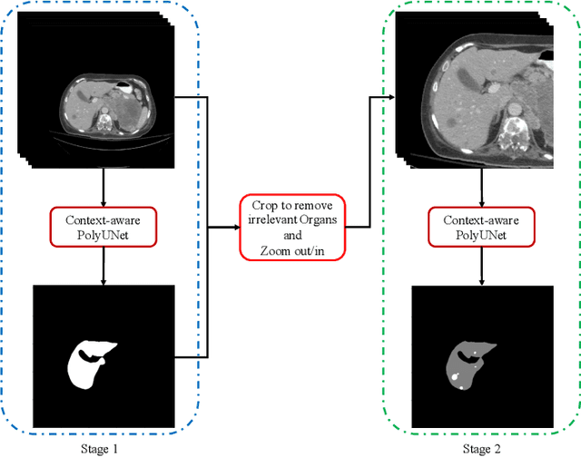 Figure 2 for Context-aware PolyUNet for Liver and Lesion Segmentation from Abdominal CT Images