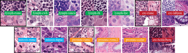 Figure 1 for Quantifying the effects of data augmentation and stain color normalization in convolutional neural networks for computational pathology