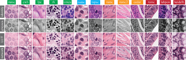 Figure 3 for Quantifying the effects of data augmentation and stain color normalization in convolutional neural networks for computational pathology