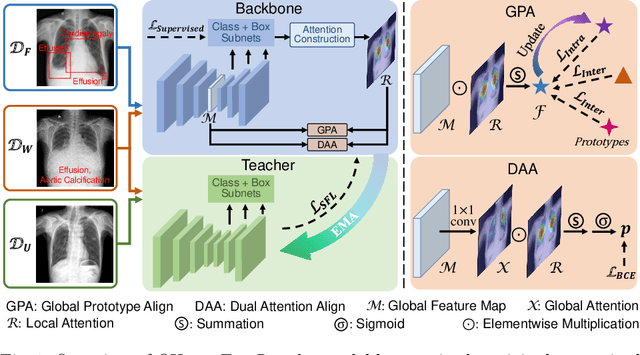 Figure 1 for OXnet: Omni-supervised Thoracic Disease Detection from Chest X-rays