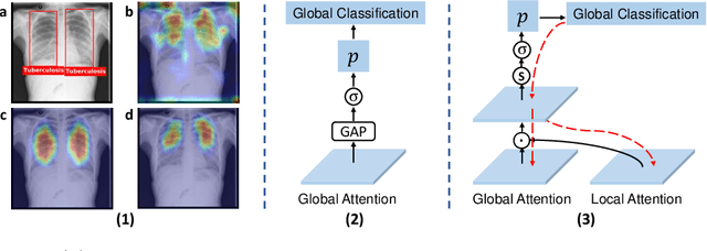 Figure 3 for OXnet: Omni-supervised Thoracic Disease Detection from Chest X-rays