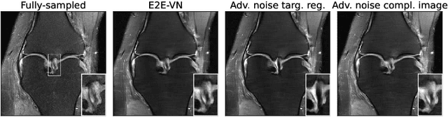 Figure 3 for Adversarial Robustness of MR Image Reconstruction under Realistic Perturbations