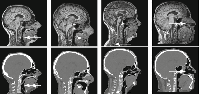Figure 3 for Deep MR to CT Synthesis using Unpaired Data
