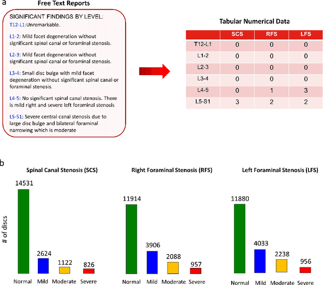 Figure 3 for DeepSPINE: Automated Lumbar Vertebral Segmentation, Disc-level Designation, and Spinal Stenosis Grading Using Deep Learning