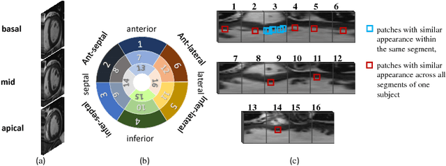 Figure 2 for Cardiac Motion Scoring with Segment- and Subject-level Non-Local Modeling