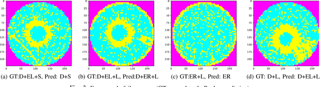 Figure 3 for WaferSegClassNet -- A Light-weight Network for Classification and Segmentation of Semiconductor Wafer Defects