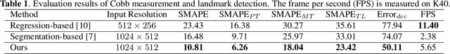 Figure 2 for Vertebra-Focused Landmark Detection for Scoliosis Assessment