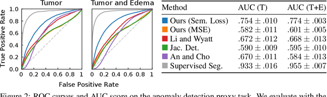 Figure 2 for Spot the Difference: Topological Anomaly Detection via Geometric Alignment