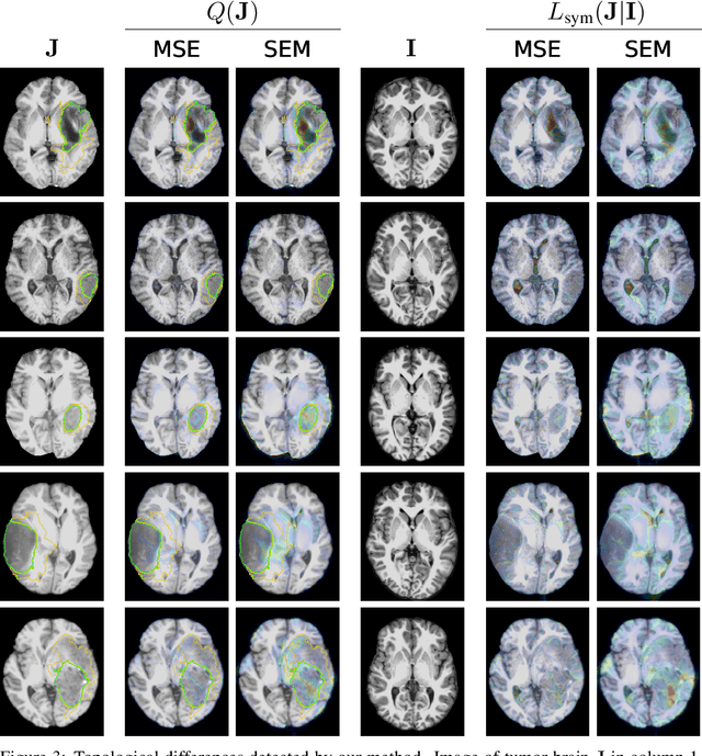 Figure 3 for Spot the Difference: Topological Anomaly Detection via Geometric Alignment