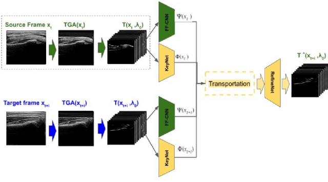 Figure 1 for Domain Specific Transporter Framework to Detect Fractures in Ultrasound