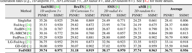 Figure 4 for Specificity-Preserving Federated Learning for MR Image Reconstruction