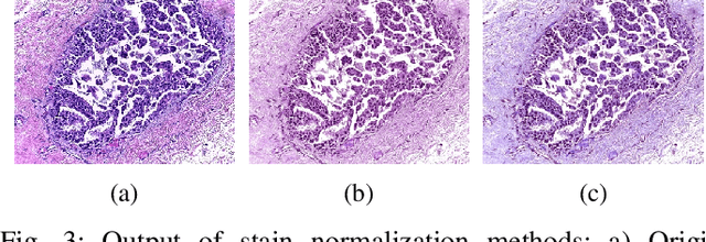 Figure 3 for Breast Cancer Diagnosis with Transfer Learning and Global Pooling