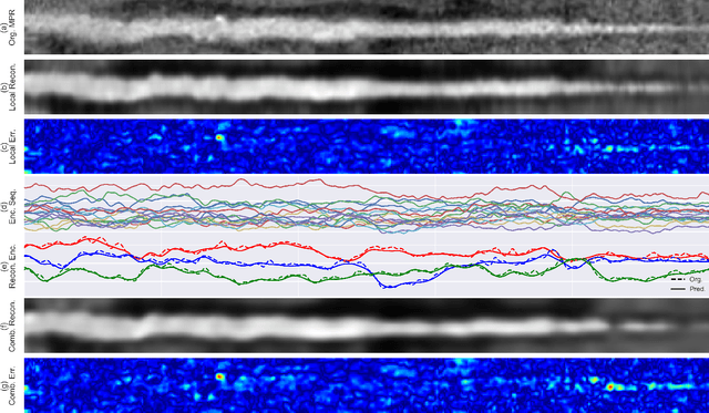 Figure 4 for Deep learning analysis of cardiac CT angiography for detection of coronary arteries with functionally significant stenosis
