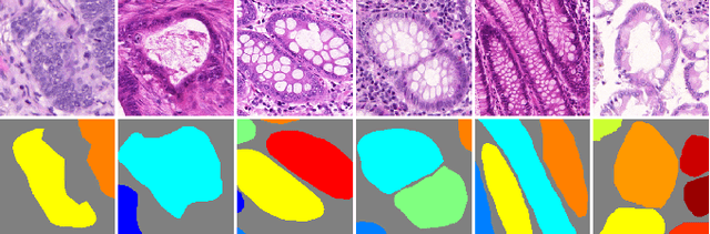 Figure 1 for Gland Instance Segmentation by Deep Multichannel Neural Networks