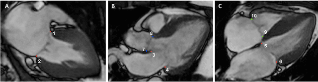 Figure 1 for Estimation of Cardiac Valve Annuli Motion with Deep Learning