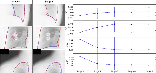 Figure 3 for Accurate Lung Segmentation via Network-Wise Training of Convolutional Networks