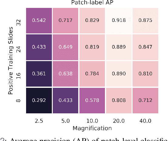 Figure 2 for Deep Learning-Based Sparse Whole-Slide Image Analysis for the Diagnosis of Gastric Intestinal Metaplasia