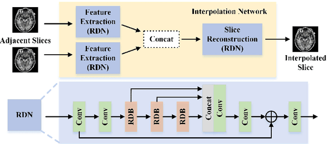 Figure 3 for Two-Stage Self-Supervised Cycle-Consistency Network for Reconstruction of Thin-Slice MR Images
