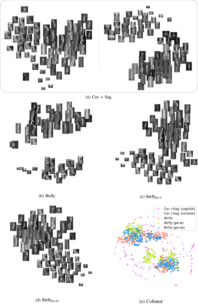 Figure 3 for Adversarially Learning a Local Anatomical Prior: Vertebrae Labelling with 2D reformations