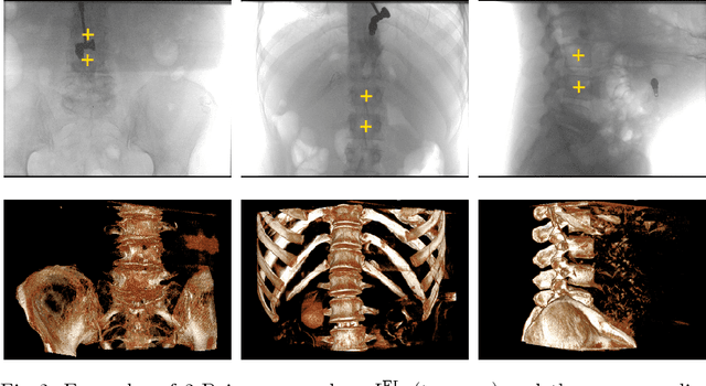 Figure 2 for Metric-Driven Learning of Correspondence Weighting for 2-D/3-D Image Registration