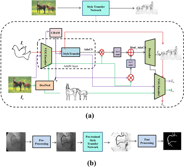 Figure 1 for Style Transfer based Coronary Artery Segmentation in X-ray Angiogram