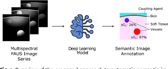 Figure 1 for Semantic segmentation of multispectral photoacoustic images using deep learning