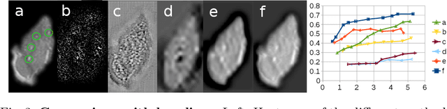 Figure 4 for GP-Unet: Lesion Detection from Weak Labels with a 3D Regression Network