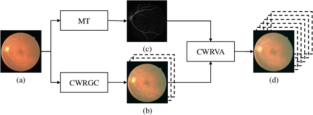 Figure 1 for Robust Retinal Vessel Segmentation from a Data Augmentation Perspective