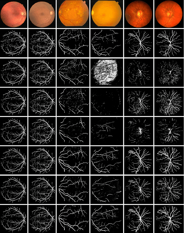 Figure 3 for Robust Retinal Vessel Segmentation from a Data Augmentation Perspective