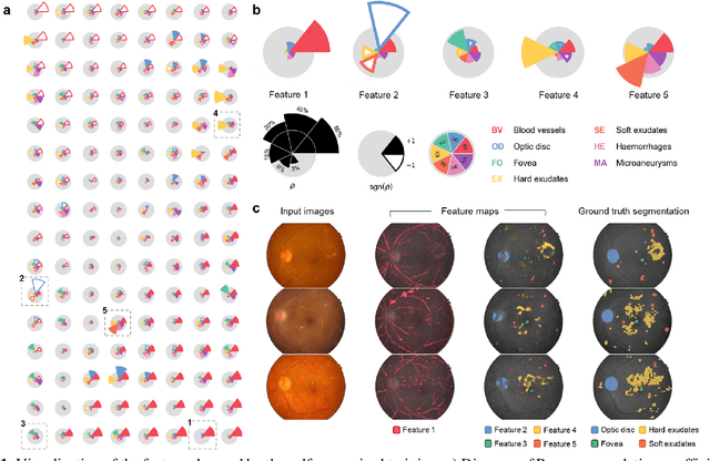 Figure 1 for Self-Supervised Learning from Unlabeled Fundus Photographs Improves Segmentation of the Retina