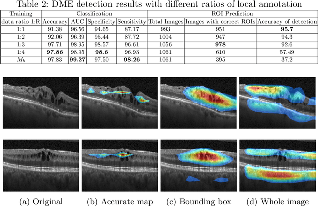 Figure 4 for Explainable Disease Classification via weakly-supervised segmentation