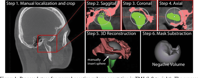Figure 1 for Deep Negative Volume Segmentation
