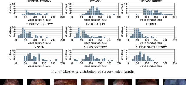 Figure 4 for Future-State Predicting LSTM for Early Surgery Type Recognition