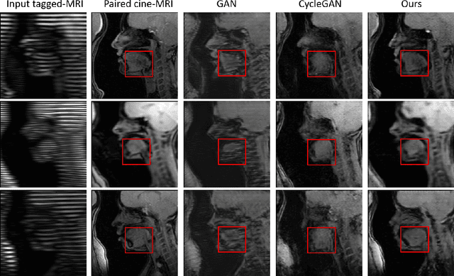 Figure 3 for Structure-aware Unsupervised Tagged-to-Cine MRI Synthesis with Self Disentanglement