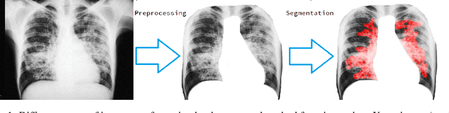 Figure 1 for ClamNet: Using contrastive learning with variable depth Unets for medical image segmentation