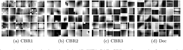 Figure 3 for 3D medical image segmentation with labeled and unlabeled data using autoencoders at the example of liver segmentation in CT images