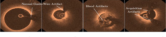 Figure 1 for Adversarial Training for Patient-Independent Feature Learning with IVOCT Data for Plaque Classification