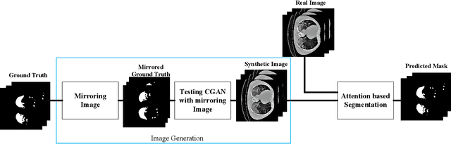 Figure 1 for Segmentation of Lungs COVID Infected Regions by Attention Mechanism and Synthetic Data