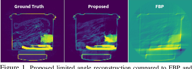 Figure 1 for Lose The Views: Limited Angle CT Reconstruction via Implicit Sinogram Completion
