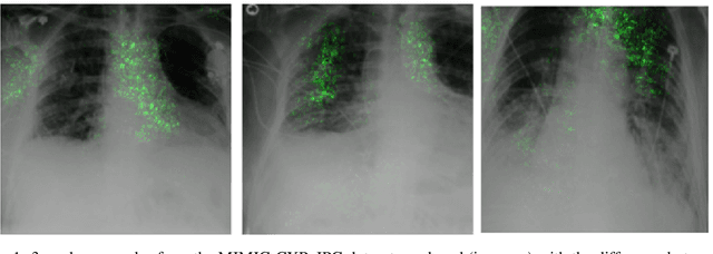 Figure 1 for Agree to Disagree: When Deep Learning Models With Identical Architectures Produce Distinct Explanations