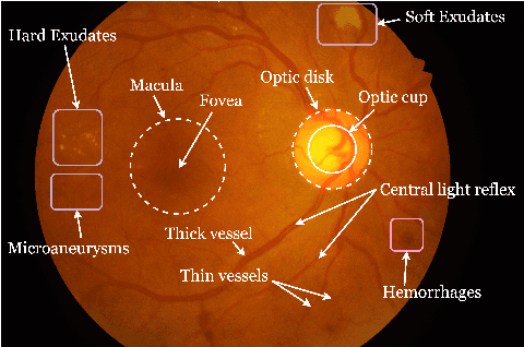 Figure 1 for Application of Top-hat Transformation for Enhanced Blood Vessel Extraction