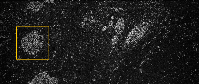 Figure 3 for Normalized K-Means for Noise-Insensitive Multi-Dimensional Feature Learning