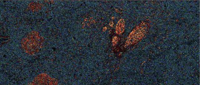 Figure 4 for Normalized K-Means for Noise-Insensitive Multi-Dimensional Feature Learning