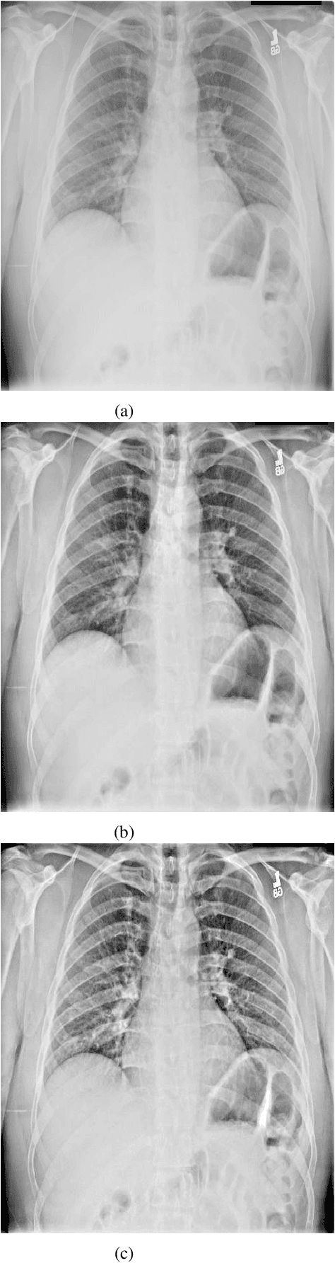 Figure 3 for Contrast Enhancement of Medical X-Ray Image Using Morphological Operators with Optimal Structuring Element