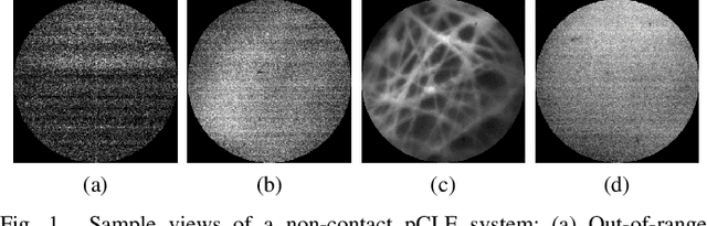 Figure 1 for Hybrid Robotic-assisted Frameworks for Endomicroscopy Scanning in Retinal Surgeries