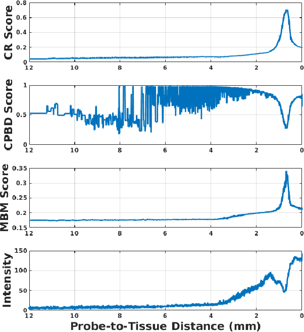 Figure 3 for Hybrid Robotic-assisted Frameworks for Endomicroscopy Scanning in Retinal Surgeries