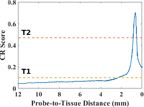 Figure 4 for Hybrid Robotic-assisted Frameworks for Endomicroscopy Scanning in Retinal Surgeries