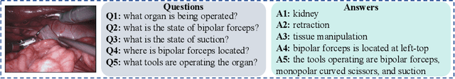 Figure 1 for Surgical-VQA: Visual Question Answering in Surgical Scenes using Transformer