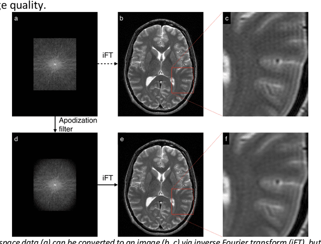 Figure 1 for Performance characterization of a novel deep learning-based MR image reconstruction pipeline